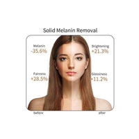 Vitamin C Serum (100ml)